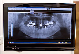歯や骨の診察・診断