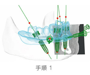 手順1